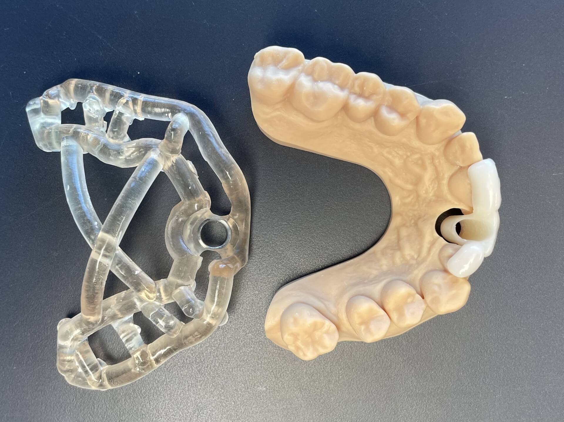 implant dentaire labo martinique lgcaraibes