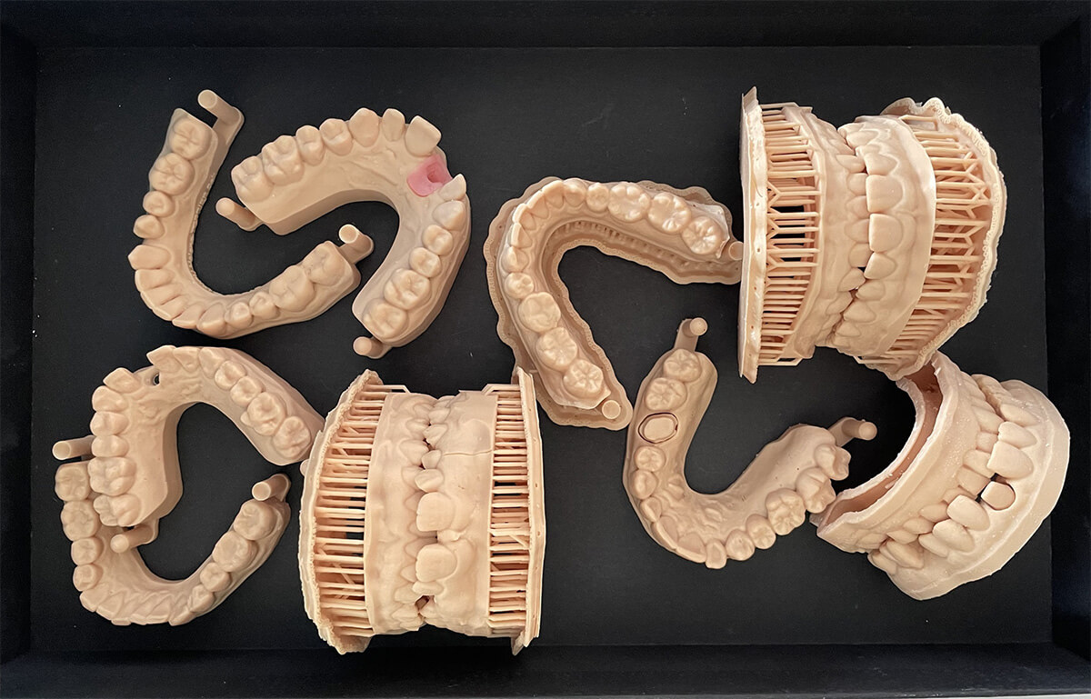 impression 3D Labo Dentiste LGCaraibes