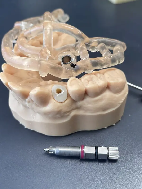 guide-chirurgical-sur-modele-imprime-3d