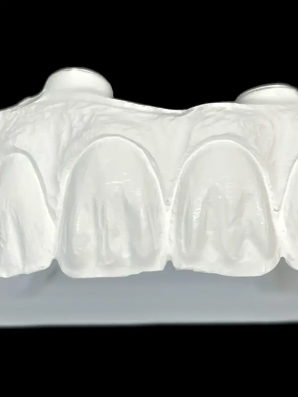 modele-dentaire-au-laboratoire-de-prothese